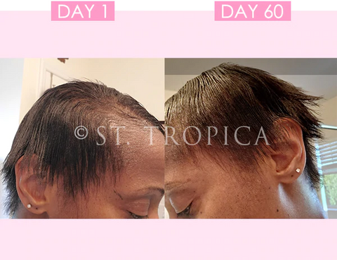 ST.Tropica