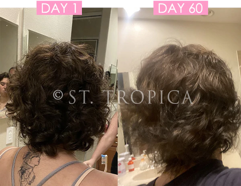 ST.Tropica