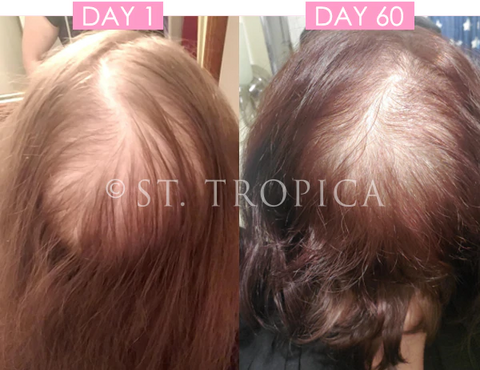 ST.Tropica