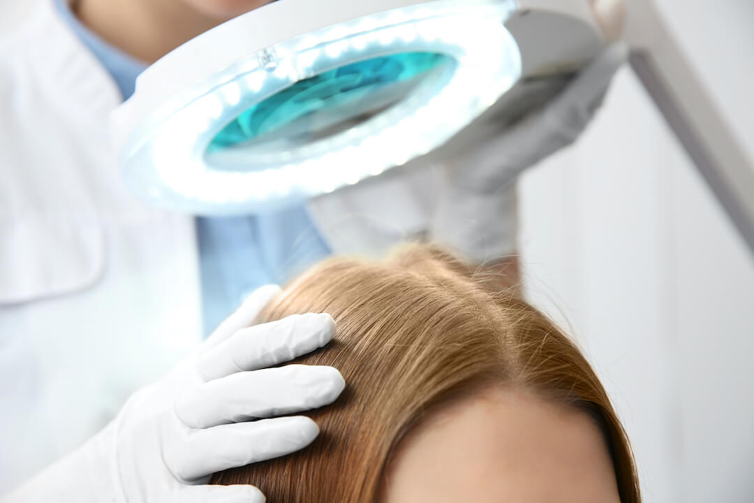 Doctor looking at blonde woman's scalp under a bright light to identify scalp issues.