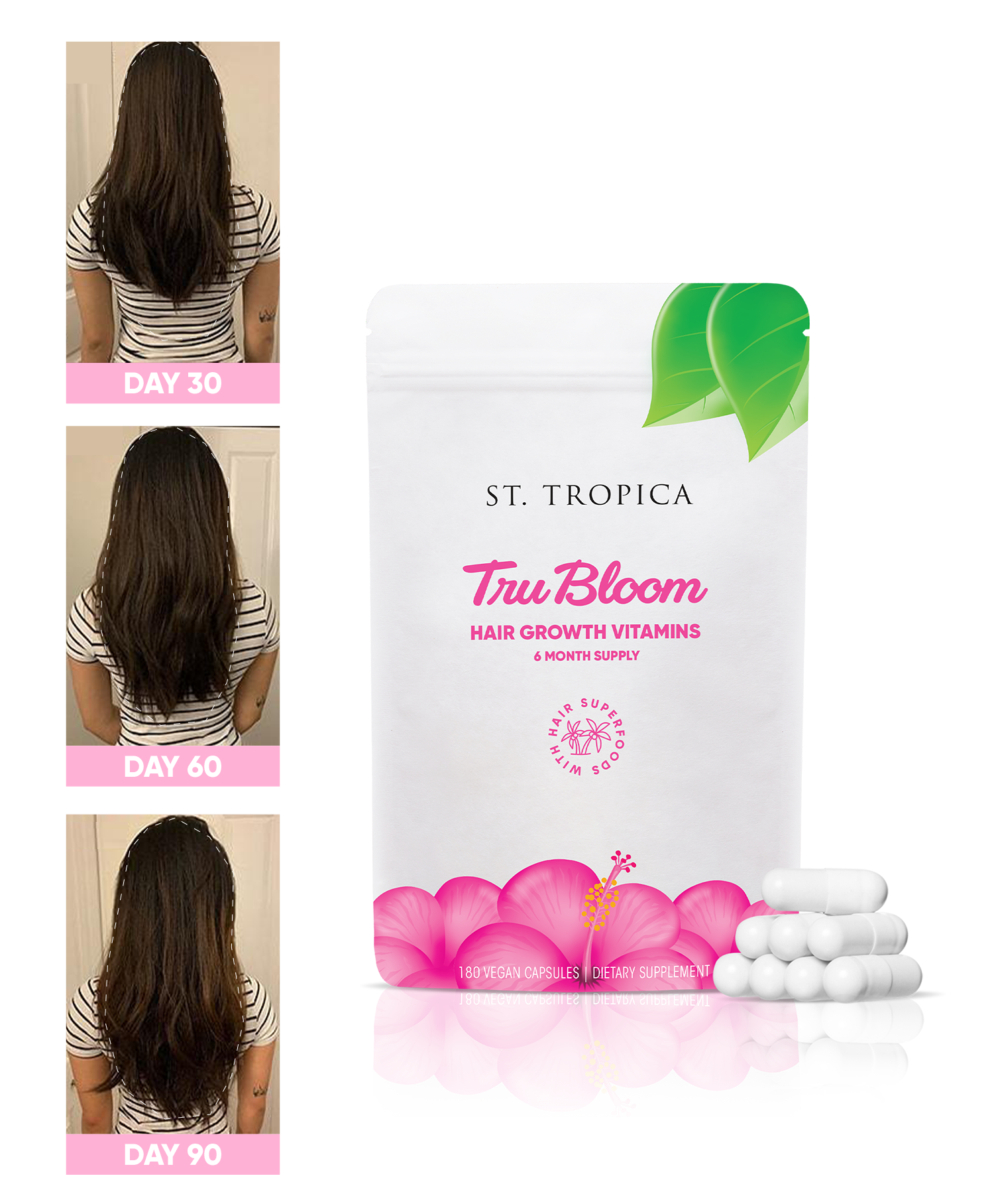 ST. TROPICA Hair Growth Vitamins 6 Month Supply