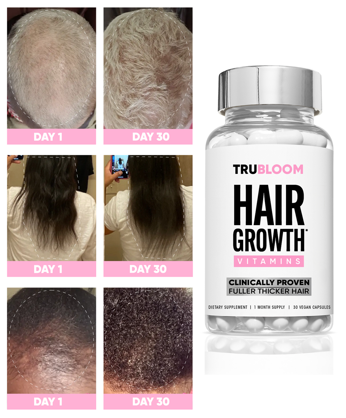 ST. TROPICA Hair Growth Vitamins - 1 Month Supply
