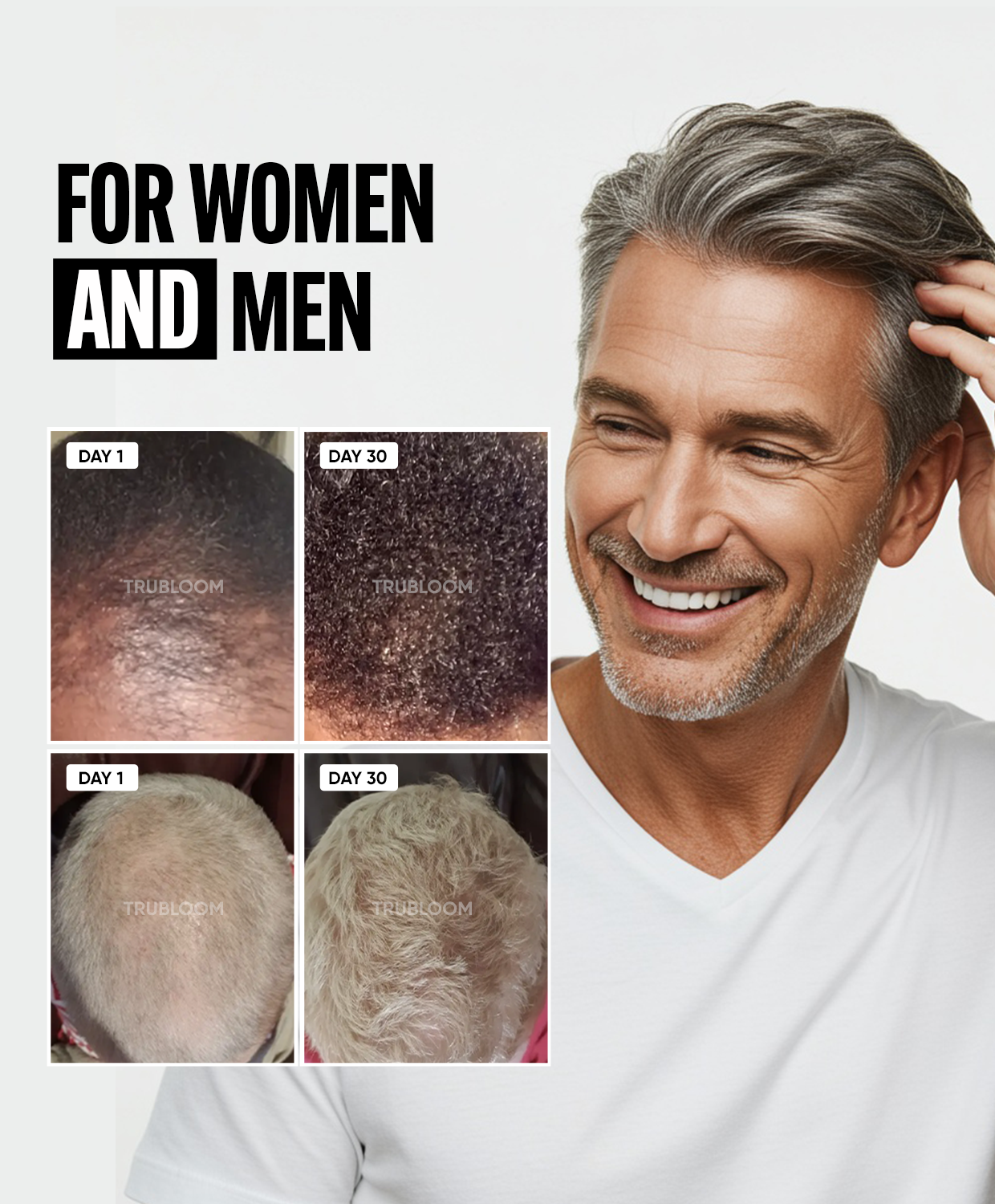 
  
  ST. TROPICA Collection
  
