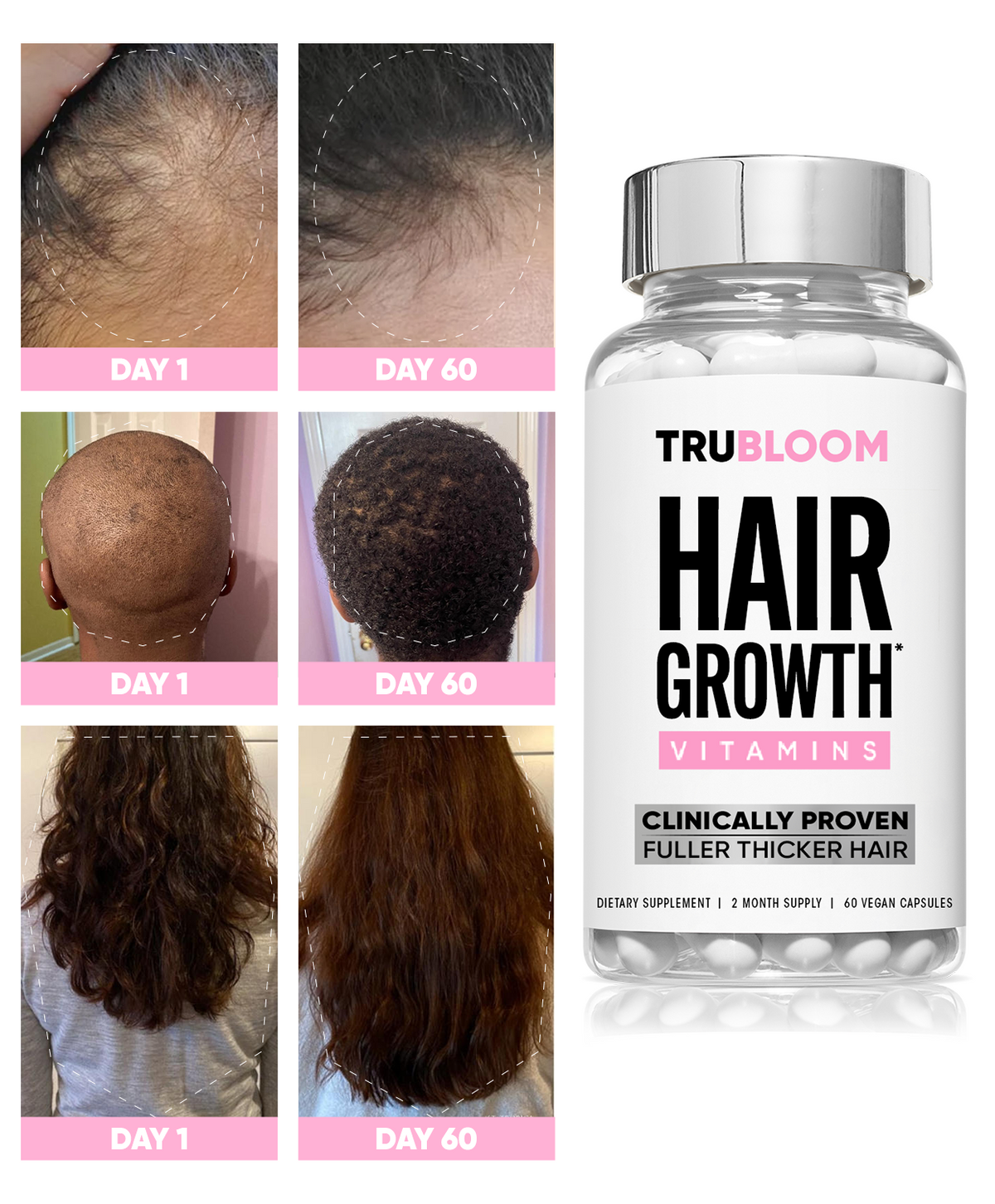 ST. TROPICA Hair Growth Vitamins - 60 Day Hair Challenge (2 Month Supply)