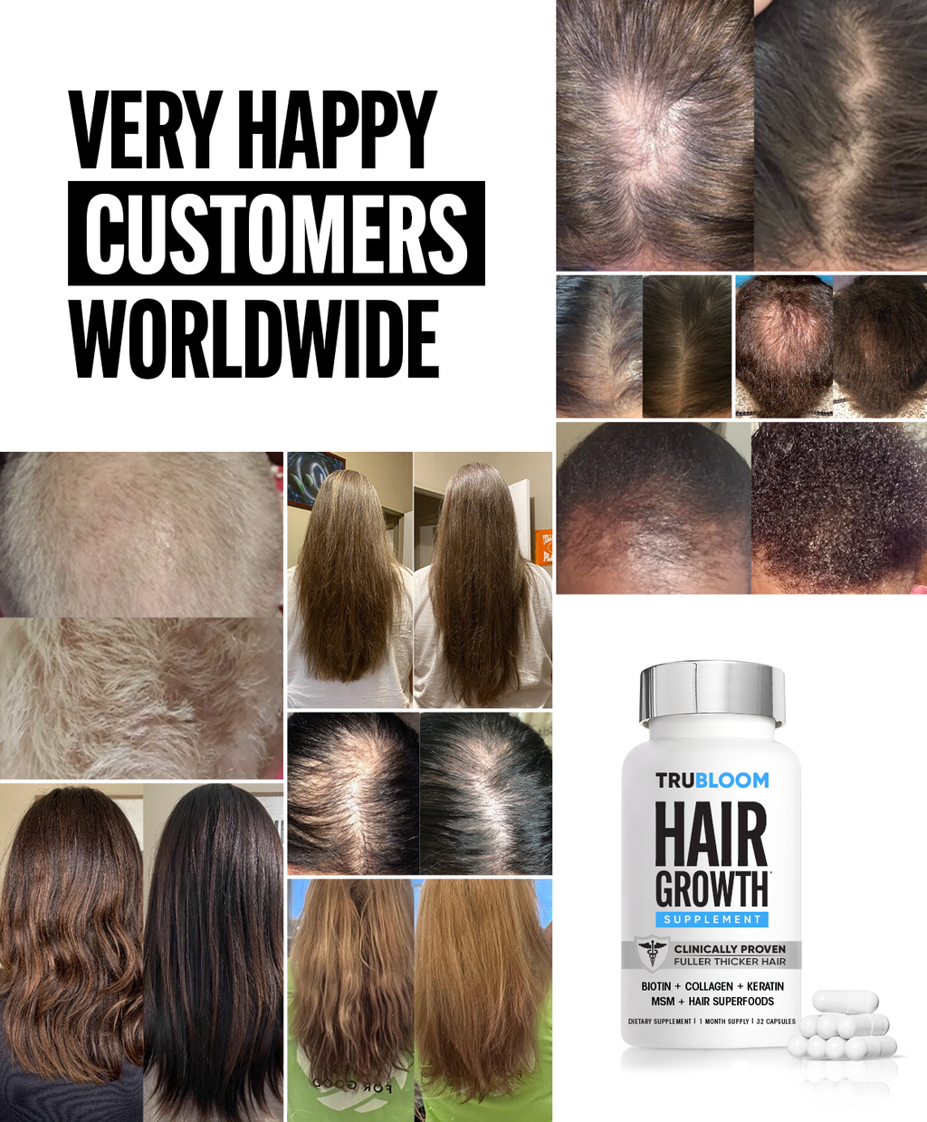 TRU BLOOM Hair Growth Vitamins - 1 Month Supply