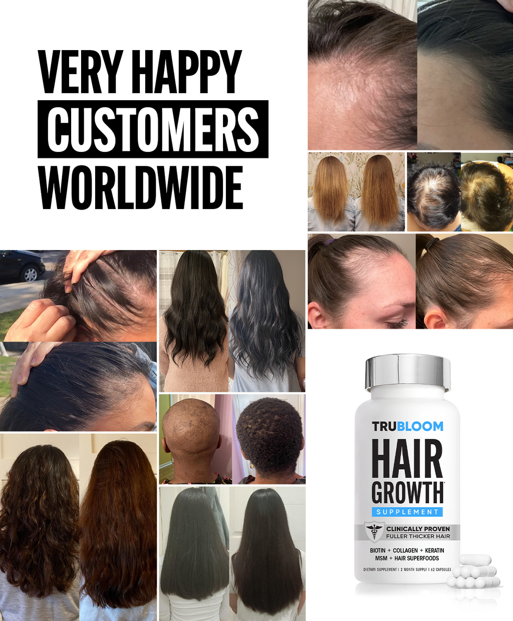 TRU BLOOM Hair Growth Vitamins - 60 Day Hair Challenge (2 Month Supply)