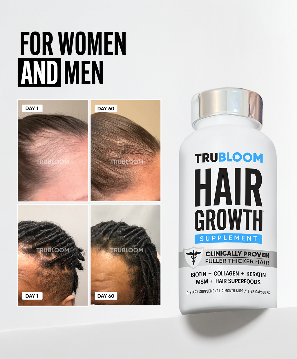 TRU BLOOM Hair Growth Vitamins - 60 Day Hair Challenge (2 Month Supply)