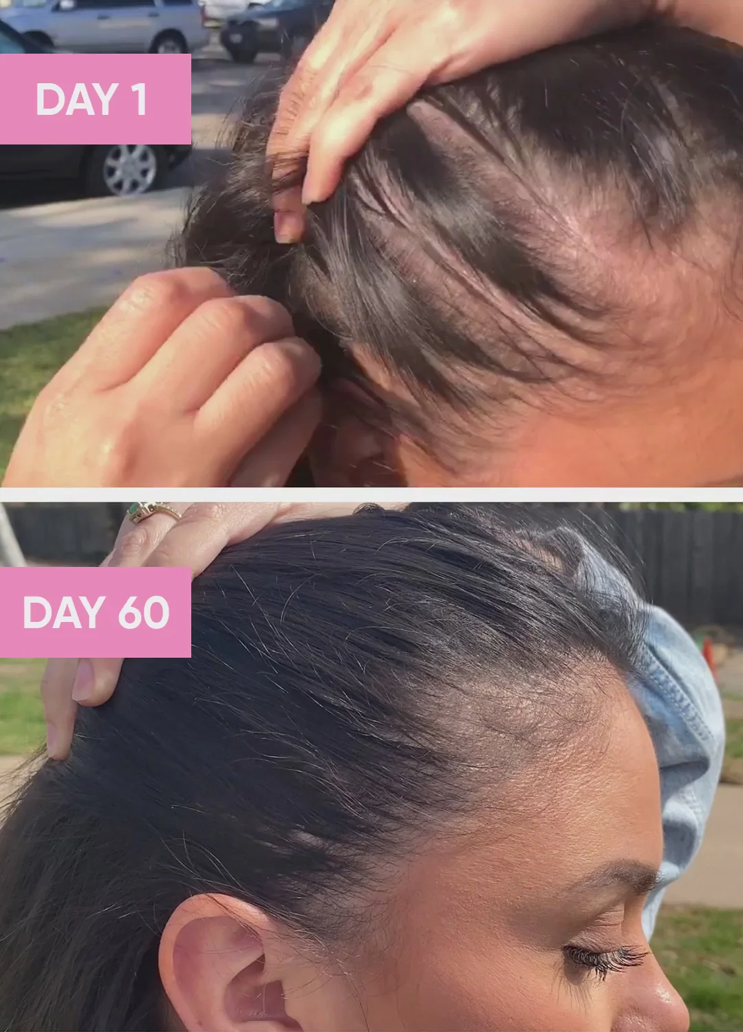 Hair Vitamin Gummy